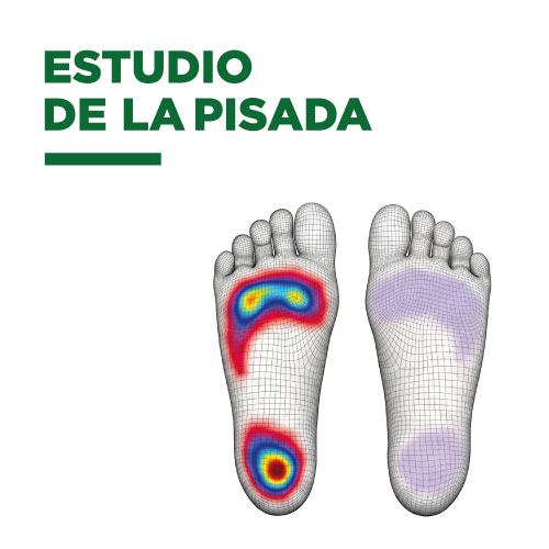 Estudio de la pisada